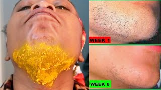 JUST 2 INGREDIENTS REMOVE FACIAL HAIR REMOVE FACIAL HAIR PERMANENTLY CHIN  UPPER LIPS [upl. by Jeffcott]