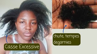 Tempes dégarnies alopécie de traction Cheveux Morts 3 Causes Surprenantes [upl. by Hodosh]