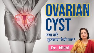 😱Ovarian Cyst क्या होता है क्यों होता है❇️Ovarian Cyst से कैसे छुटकारा पाएं Ovarian Cyst in Hindi [upl. by Silin]