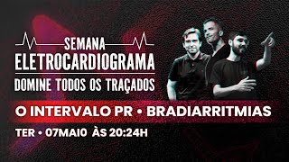 Semana ECG  O Intervalo PR [upl. by Zilada]