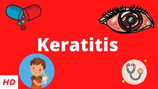 Keratitis Causes Signs and Symptoms Diagnosis and Treatment [upl. by Selle]