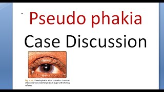 Ophthalmology Pseudophakia History Taking Examination Case Presentation Discussion IOL [upl. by Leva]