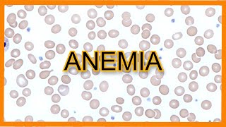 Anemia Types Findings Lab Values [upl. by Ennalyrehc]