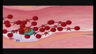 Transglutaminase in blood coagulation Factor XIIIa FXIIIa Crosslinking of fibrin [upl. by Laughlin]