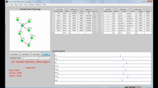 VHM Virtual heart model AVNRT simulation [upl. by Anerres]