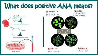 Positive ANA test antinuclear antibodies and autoimmune diseases [upl. by Steven719]