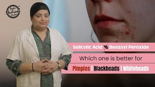 Salicylic Acid vs Benzoyl Peroxide  Get Rid of Pimples Blackheads amp Whiteheads  Dr Nivedita Dadu [upl. by Stclair595]