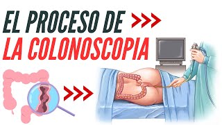 Todo lo que Debes Saber sobre la Colonoscopia y Salud del Colon [upl. by Handy933]