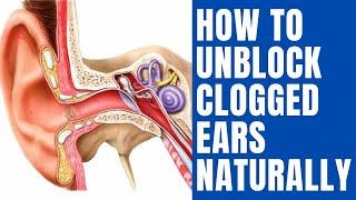 How To Unblock Clogged Ears Naturally  10 Proven Home Remedies for Clogged Ears [upl. by Keenan]