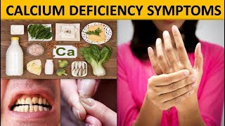 Calcium Deficiency Symptoms लक्षण जो बताते है कैल्शियम की कमी  calcium ki kami ke lakshan [upl. by Eladal761]