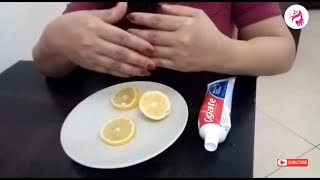 Magical Result  baking soda Lemon Colgate Toothpaste and Tomato Facial  Home Remedies [upl. by Nellie341]