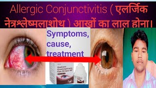 Allergic Conjunctivitis  एलर्जिक नेत्रश्लेष्मलाशोथ Abhia2zmedicalSymptoms cause treatment [upl. by Naeruat]