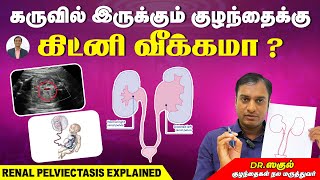 கருவில் இருக்கும் குழந்தைக்கு கிட்னி வீக்கமா   Renal Pelviectasis  Dr Saguls Paediatric corner [upl. by Akihsat]