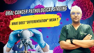 Dr Rudra Mohan Histopathological Staging  Differentiation Of Oral Cancer  Simplified at a glance [upl. by Rianna]