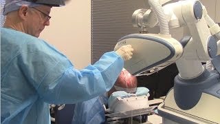 Robotic Hair Transplant Recipient Site Creation with the ARTAS FUE Robot [upl. by Erihppas]