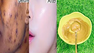 Multani mitti face pack for skin whitening  Skin whitening home remedies  Face pack at home [upl. by Holly-Anne968]