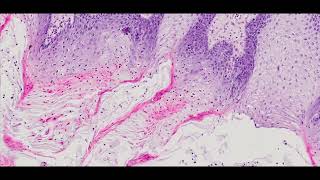 The tongue with filiform and circumvallate papillae  PUMS Histology Slides Review Series [upl. by Akeme]