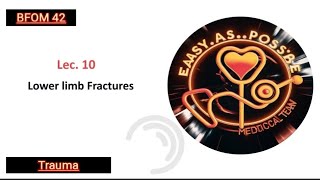 Lecture 10  Lower Limb Fractures  Trauma 42 [upl. by Atwekk561]