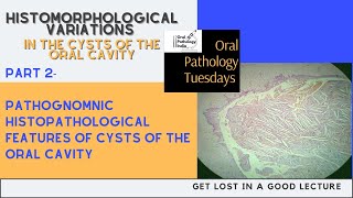 Histomorphological Variations in oral cysts part 2 Histopathology\Oral Pathology 360 Fundamentals [upl. by Harle]