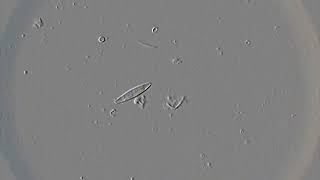 Diatoms in action [upl. by Arykat]