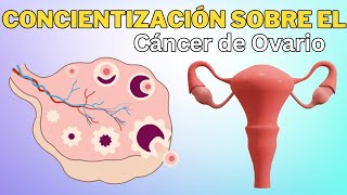 Concientización sobre el cáncer de ovario causas diagnóstico y tratamiento oncológico ginecológico [upl. by Kyriako]