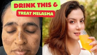 Drink this to treat Melasma amp Pigmentation  Nipun Kapur [upl. by Bobseine]