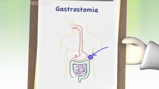 03 Vias de administração da dieta enteral ou por sonda [upl. by Kenney]