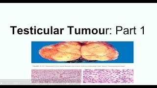 Seminoma Clinical picture Morphology and staging [upl. by Dlanor]