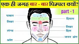 पिम्पल कील मुहासे हमेशा के लिए ख़त्म करने का असरदार तरीका  Acne pimples permanent solution part1 [upl. by Tartaglia467]