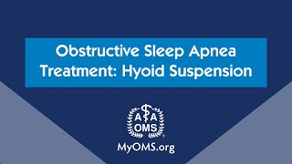 Obstructive Sleep Apnea Treatment Hyoid Suspension [upl. by Spearing611]