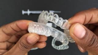 How to use Tooth Whitening Trays [upl. by Gaillard751]