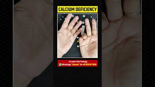 Calcium Deficiency Symptoms amp Treatment By Acupressure [upl. by Anihc]