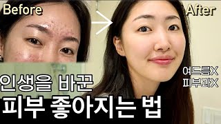 Eng cc 피부과에선 안알려준 돈 안들이고 피부 좋아지는 법✨ 좀 더 일찍 알았더라면🤦🏻‍♀️ [upl. by Dnumyar167]