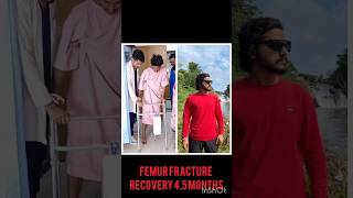 FEMUR FRACTURE RECOVERY IN JUST 45 MONTH femurbonephysiotherapy femurfracture orthopedicsfit [upl. by Eenaj]