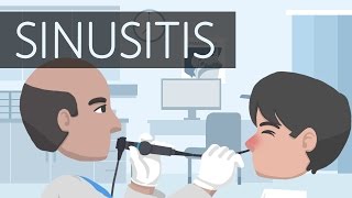 What is Sinusitis [upl. by Bunny]