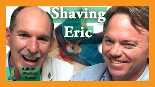 Shave Biopsy on Eric  Auburn Medical Group [upl. by Luoar]