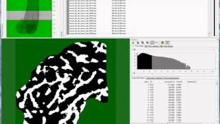 Adaptive thresholding of trabecular bone [upl. by Jerroll767]