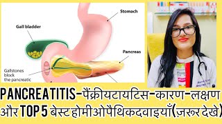 Pancreatitis Best Homeopathic Medicineपैंक्रीयटायटिस की बेस्ट होमीओपैथिक दवाइयाँ Pancreatitis Test [upl. by Waterer]