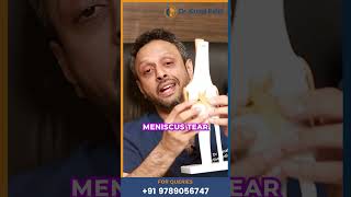 Meniscus TearSports InjuryDrKunal PatelOrthopedic Surgeon kneepain meniscus meniscustear [upl. by Drofub]