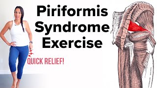 The Best Piriformis Syndrome Exercise For Lasting Relief [upl. by Eamaj]