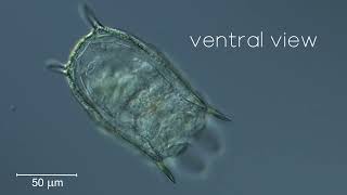 Rotifer Keratella serrulata serrulata [upl. by Gaige42]