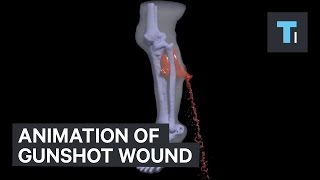 Animation of gunshot wound [upl. by Sheri]