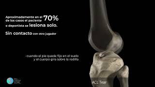 LESION DEL LIGAMENTO CRUZADO ANTERIOR [upl. by Ilenna849]