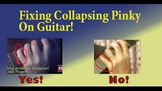 Collapsing Pinky on Guitar  Fix with this Pinky Finger Exercise guitarexercisesguitarpractice [upl. by Melicent753]