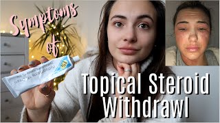 What are the symptoms of Topical Steroid Withdrawal [upl. by Marrilee]