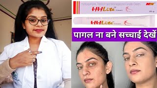 Skin Whitening HH Lite Skin Cream honest reviewHHLite cream benefits amp Sids effects review inhindi [upl. by Cad]