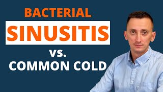 Acute Sinusitis Symptoms [upl. by Giles207]