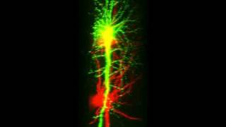 Double labeled neurons of brain slices [upl. by Artemus]