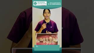 Why Replacing Missing Teeth is Crucial for Your Oral Health  LBR Dental [upl. by Meares45]