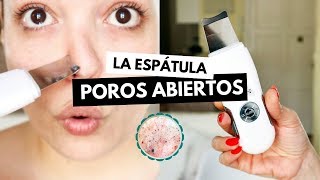 Pruebo la ESPÁTULA ULTRASÓNICA contra POROS ABIERTOS y sebo facial  Pretty and Olé [upl. by Eetse]